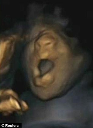 Anne karnındaki bebeğin esneme anları - Resim: 4