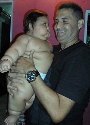 Kolombiya'nın en obez çocuğu tedavi altında - Resim: 2