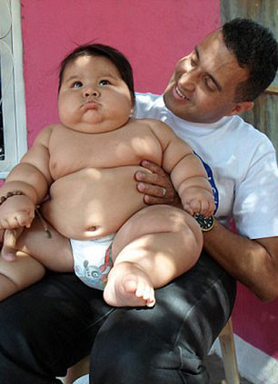 Kolombiya'nın en obez çocuğu tedavi altında - Resim: 3