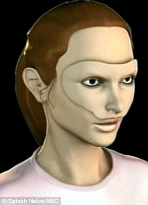 Yüzsüz kadına protez maske - Resim: 2