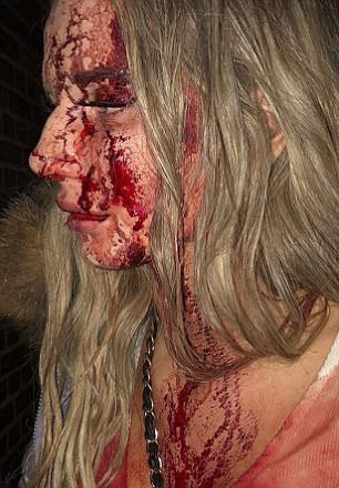 Bu hale getirdi gece kulübünde önce tacize uğradı sonra da... - Resim: 3