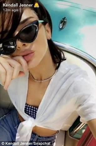 Kendall Jenner yüzüne ne yaptırdı? - Resim: 3