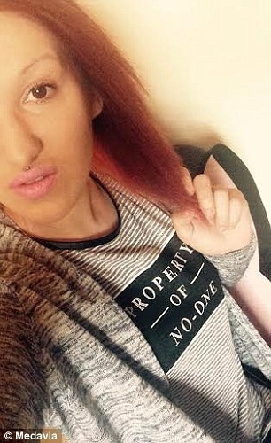 Sevgilisini yemeye çalıştı 21 kez ısırdı... - Resim: 1