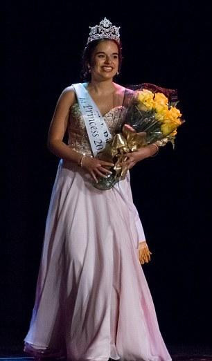 Hastalığı yüzünden bacağı 18 kilo oldu - Resim: 3