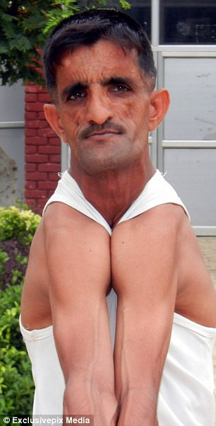 Dünyanın en garip adamı - Resim: 3