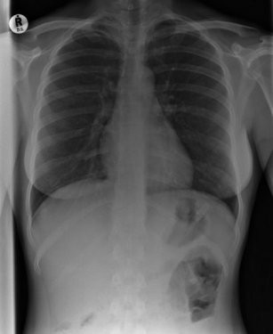 Dünyanın en ilginç röntgenleri! - Resim: 3