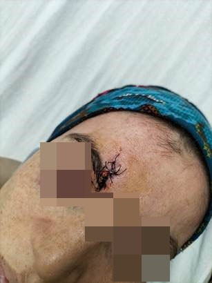 Kocası kaşını patlattı 8 dikiş atıldı! Talihsiz kadın dehşeti anlattı: Sadece cinsel ilişki... - Resim: 0