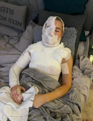 Televizyon yıldızının canlı yayındaki şişe deneyi faciayla bitti! - Resim: 4