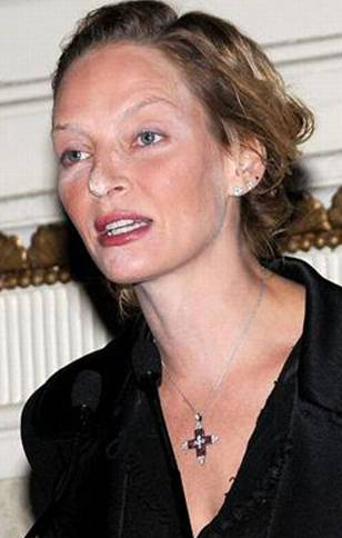 Ünlülerin defolu halleri - Resim: 4