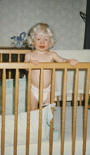 Albino genç kız taç giydi - Resim: 3