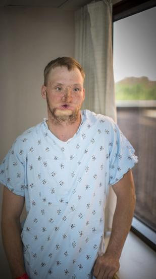 Yüzü parçalanmıştı şimdiki haline bakın - Resim: 2