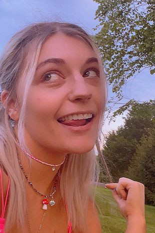 Ağrı kesici bu hale getirdi! 23 yaşındaki kadının tüm dişleri çürüyüp döküldü! - Resim: 1