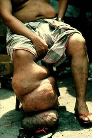 Allah düşmanımızın başına vermesin! - Resim: 2