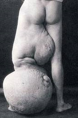 Allah düşmanımızın başına vermesin! - Resim: 4