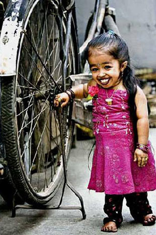 Bu genç kızın boyu su şişesi kadar - Resim: 3