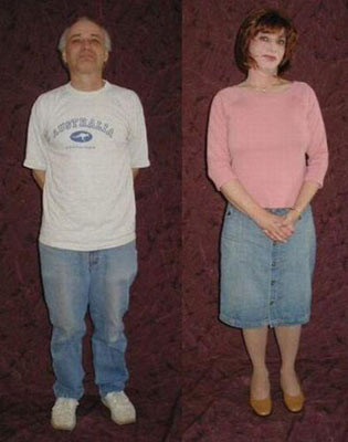 Ameliyatla kadın olan erkekler! - Resim: 3