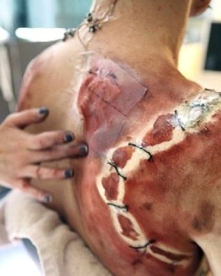 Para kazanmak için bu acıya katlanıyor! - Resim: 3