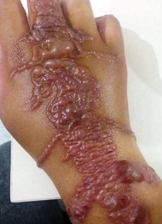 Ellerine dövme yaptırdı ama bu halde geldi korkunç görüntü! - Resim: 3