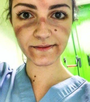 Koronaveirüsle savaşın kahramanları bunlar da kahramanlık izleri - Resim: 2