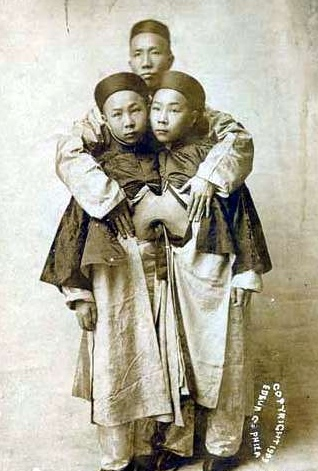 Bu ikizleri birbirinden ayırmak mümkün değil - Resim: 4