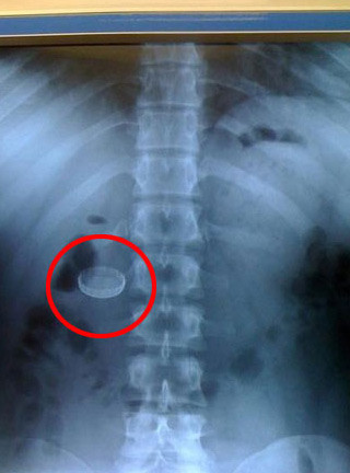 Facebook'un en ilginç kareleri - Resim: 3