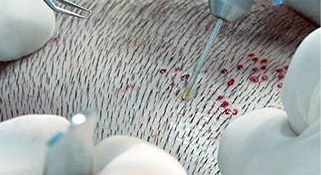 Bu ünlüler aslında kel - Resim: 2