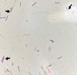 Bilim insanları uçak yakıtında yeni bir bakteri cinsi keşfetti - Resim: 2