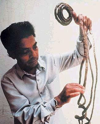 66 yıl uzattığı tırnaklarını sonunda kesti - Resim: 2