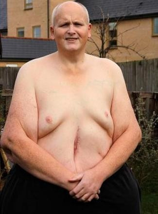 444 kiloydu ve tam 300 kilo verdi şimdi tanınmaz halde! - Resim: 4