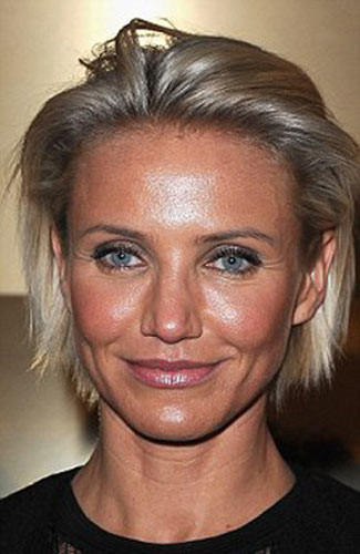 Ünlü yıldız estetik kurbanı oldu - Resim: 2