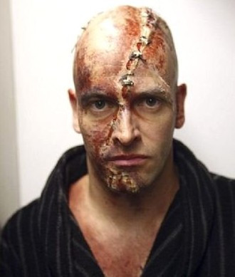 Para kazanmak için bu acıya katlanıyor! - Resim: 1