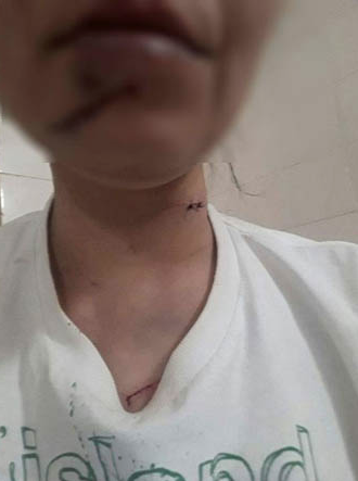 Evin kapısını kırıp banyoda kabusu yaşattı!  - Resim: 2