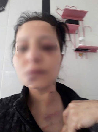 Evin kapısını kırıp banyoda kabusu yaşattı!  - Resim: 1