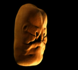 Anne karnında hayat böyle başlıyor - Resim: 4