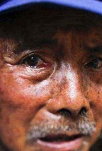 Son cüzzamlı köyü - Resim: 3