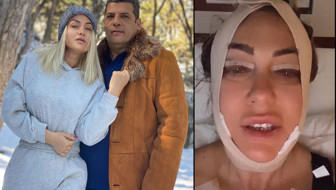 'Para veriyorsun, acı çekiyorsun' deyip paylaştı! Yeliz Yeşilmen'i gören tanıyamadı