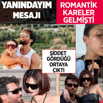 Yalıkavak tatilinden paylaşmışlardı! Can Yaman'dan şiddet gören sevgilisine büyük destek...