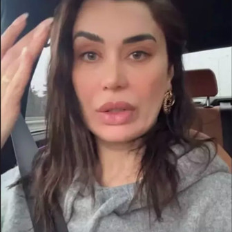 Ebru Şancı'nın son hali korkuttu! Botoks talihsizliği