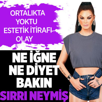 Ortalıkta görünmüyordu! Nez'den estetik açıklaması