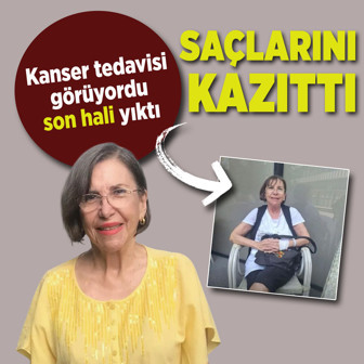 Kanser tedavisi gören Gül Onat saçlarını kazıttı! Son hali yürekleri dağladı