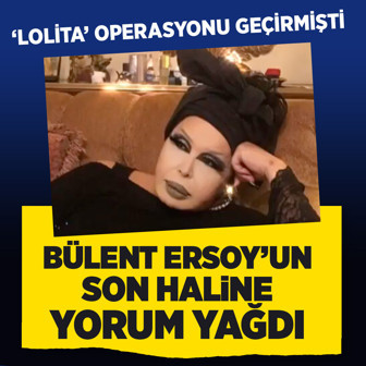 'Lolita Lift' operasyonu yaptıran Bülent Ersoy'un son haline yorum yağdı