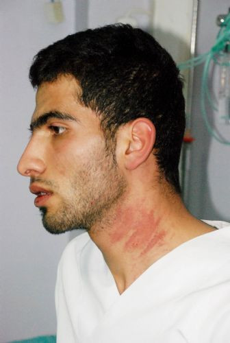 'Kızlarla yemek yedin' dayağı! - Resim: 1