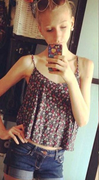 Onu görenler hayrete düşüyordu son hali ise gerçekten inanılmaz - Resim: 2