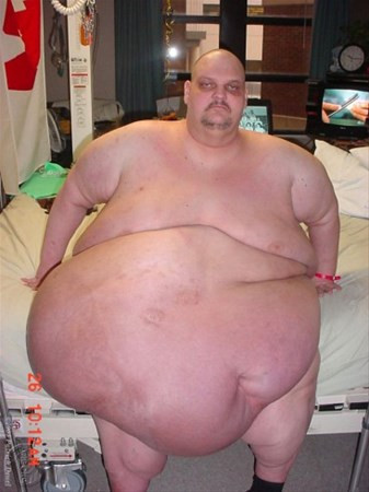 Dünyanın en kilolu insanıydı onu bekleyen son ise... - Resim: 2