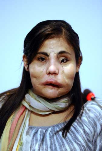 Yeni yüzüyle ilk kez kamera karşısına geçti - Resim: 2