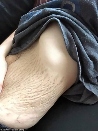 Doğum izlerini paylaştı kimse inanamadı - Resim: 4