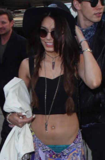 Yanlış kıyafetinin kurbanı oldu... - Resim: 3