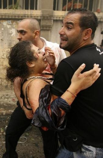 Beyrut'ta korkunç saldırı! - Resim: 3