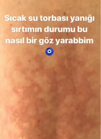 İşte o korkutan görüntü Yemekteyiz sunucusu Seda Sayan hastanelik oldu - Resim: 2