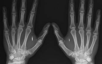 Sağ elinin kullanan daha şanslı! - Resim: 2